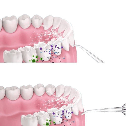 Irrigador Oral ZERO BACTÉRIA - Outlet Popular